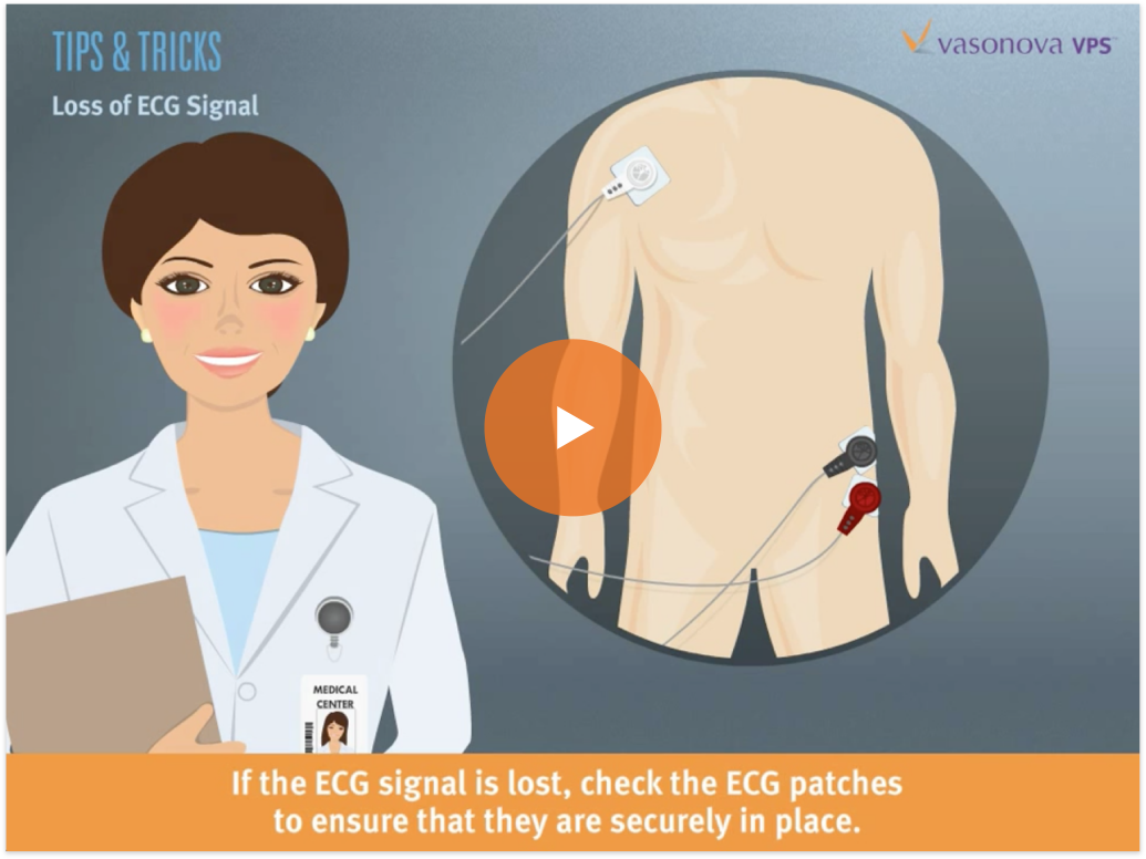 Vasonova Healthcare Startup Launch Case Study - Training and Sales Animation
